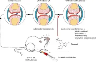 How long does it take for Etoricoxib to work