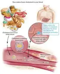 Rosuvastatin Calcium use