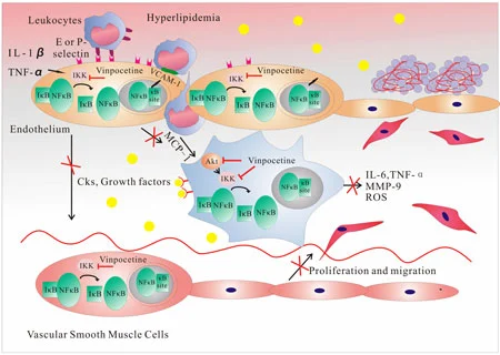 How Does Vinpocetine Work as an Anti-Inflammatory