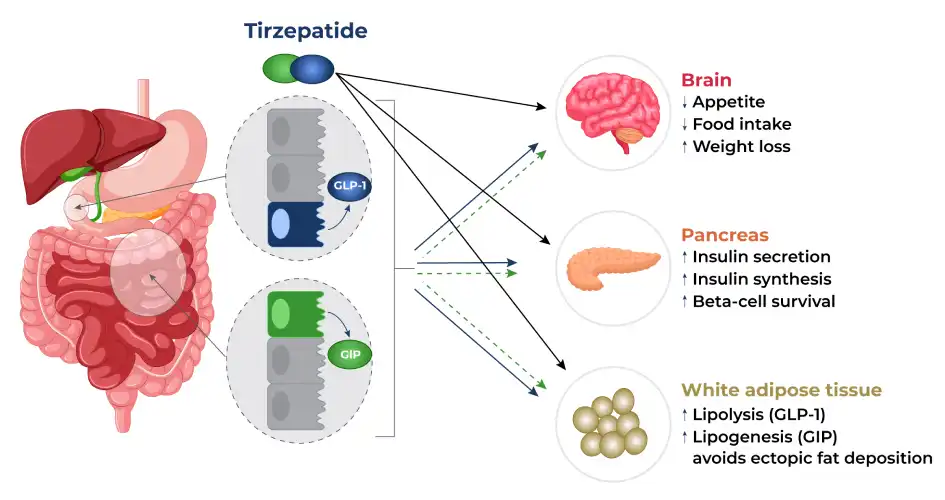 Tirzepatide for Weight Loss