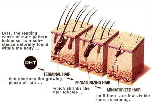 Applications of Minoxidil Powder in Hair Growth Products