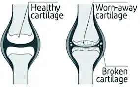 How does Diclofenac Sodium work to relieve joint pain