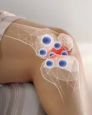 How long does it take for Diclofenac Sodium to work on joint pain